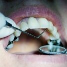 teeth at the dentist